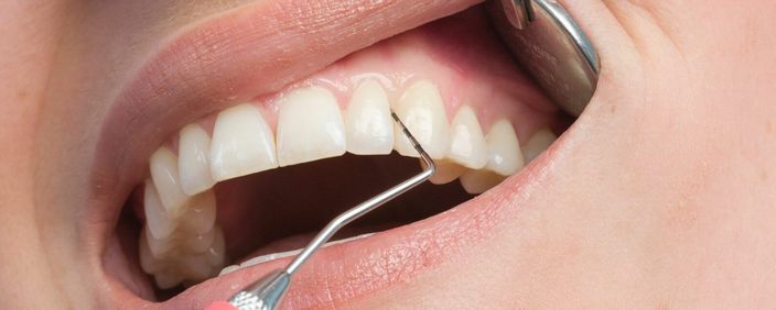 Periodontology at ELEMENTAL Day Surgical Center, Jumeirah 1, Dubai