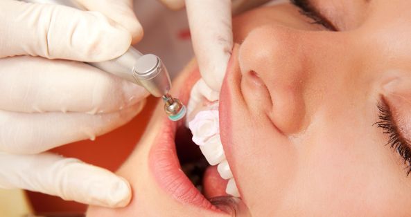Dental check-up and cleaning before teeth whitening at ELEMENTAL Day Surgical Center, Dubai