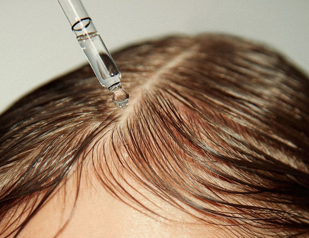 Alopecia Treatment at ELEMENTAL Day Surgical Center, Dubai