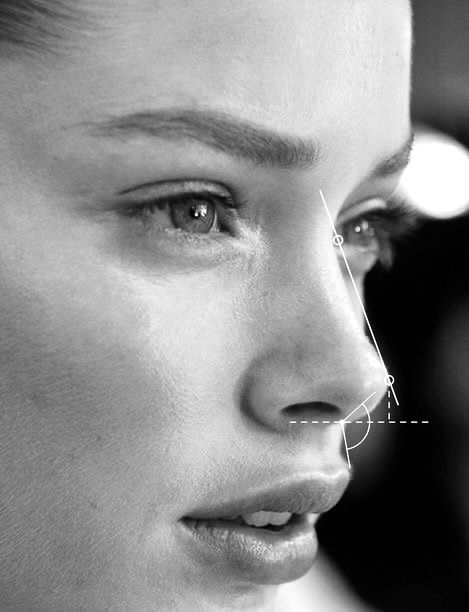Rhinoplasty at ELEMENTAL Day Surgical Center, Jumeirah 1, Dubai