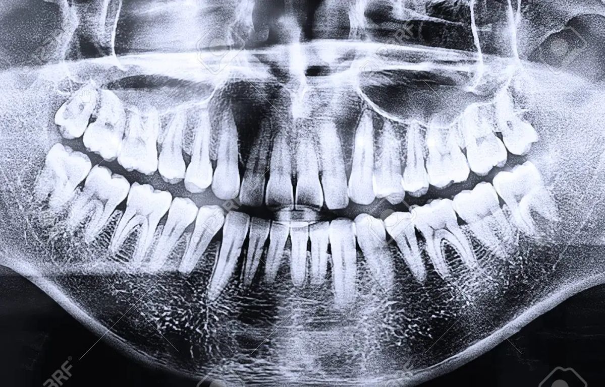 CBCT and Dental X-Ray at ELEMENTAL Day Surgical Center, Dubai