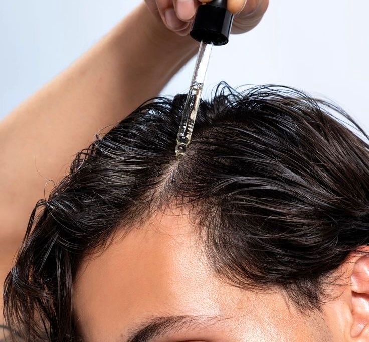 Alopecia Treatment at ELEMENTAL Day Surgical Center, Jumeirah 1, Dubai