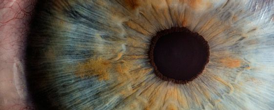 Oculoplastic and strabismus surgery at ELEMENTAL Day Surgical Center, Dubai