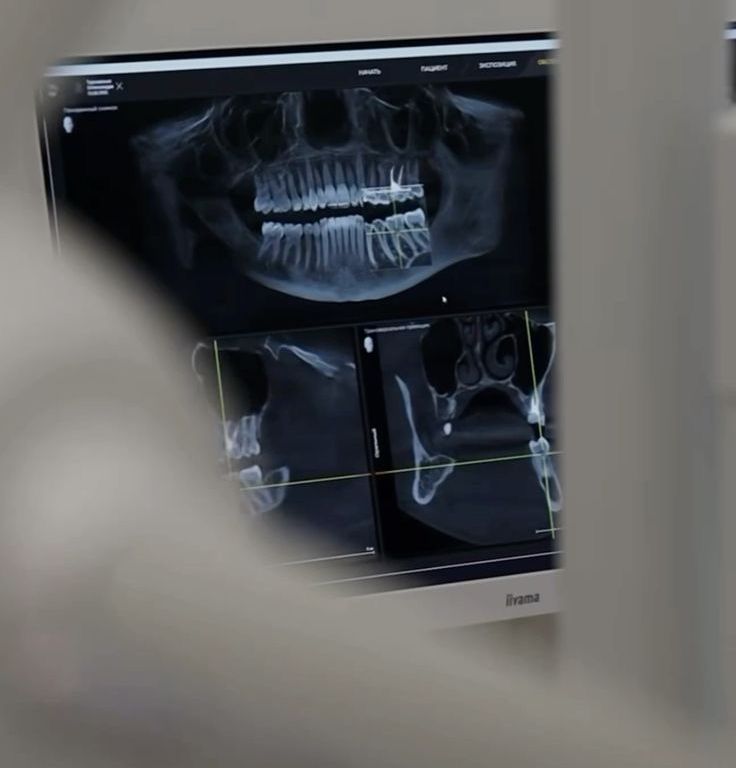 Dental CT Scan Reporting and Second Opinion at ELEMENTAL Day Surgical Center, Dubai