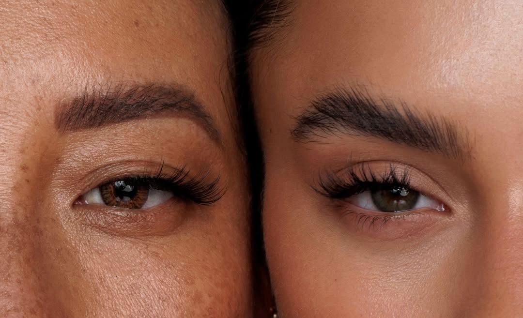 Brow lift in Dubai — direct brow lift surgery at ELEMENTAL Day Surgical Center, Jumeirah 1