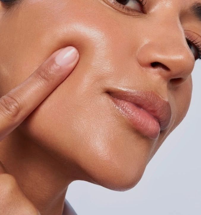 Acne and Post Acne Scar Treatment at ELEMENTAL Day Surgical Center, Dubai