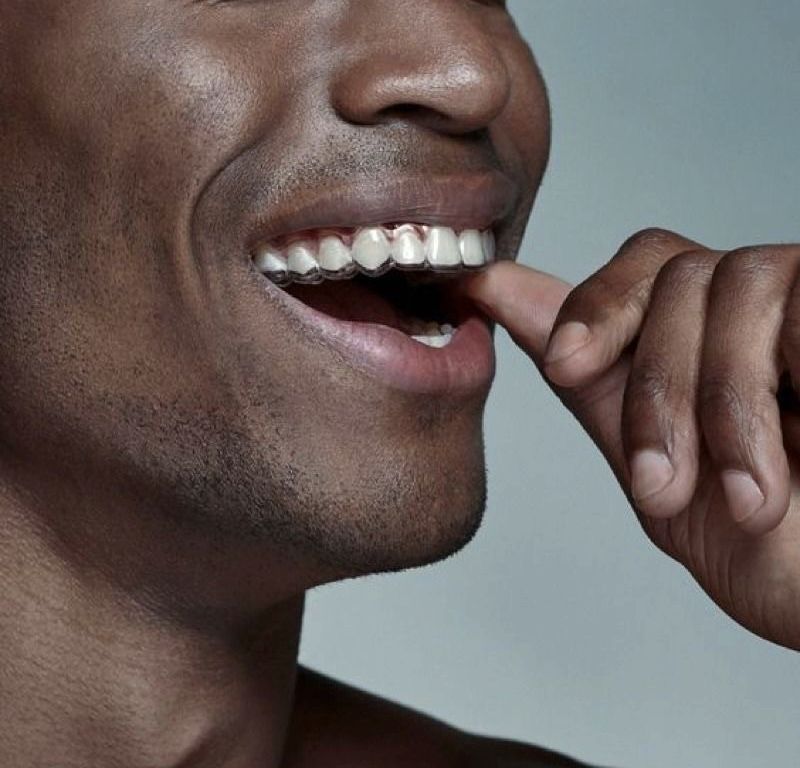 Clear Aligners at ELEMENTAL Day Surgical Center, Jumeirah 1, Dubai