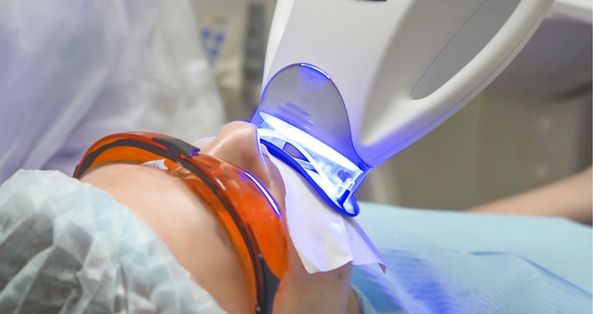 Teeth whitening result on natural enamel at ELEMENTAL Day Surgical Center, Dubai