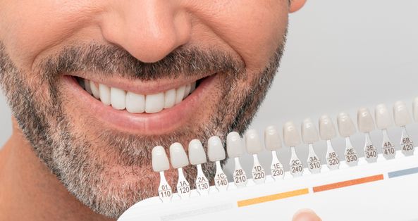 Keeping teeth whitening results — aftercare advice at ELEMENTAL Day Surgical Center, Dubai