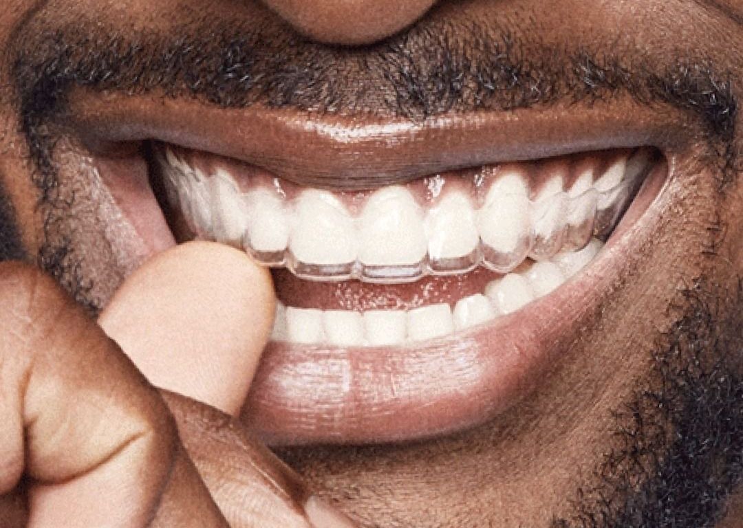 Clear Aligners at ELEMENTAL Day Surgical Center, Dubai