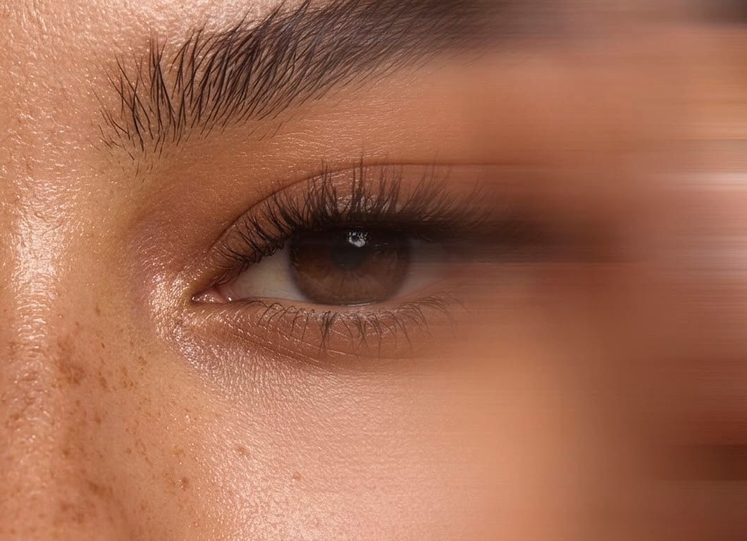 Brow lift (eyebrow and forehead lift) at ELEMENTAL Day Surgical Center, Jumeirah 1, Dubai