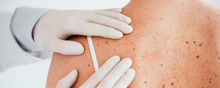 General dermatology at ELEMENTAL Day Surgical Center, Jumeirah 1, Dubai