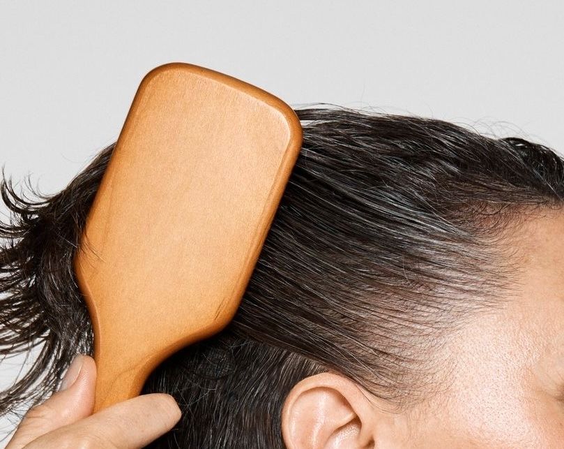 Hair Loss Treatment at ELEMENTAL Day Surgical Center, Jumeirah 1, Dubai